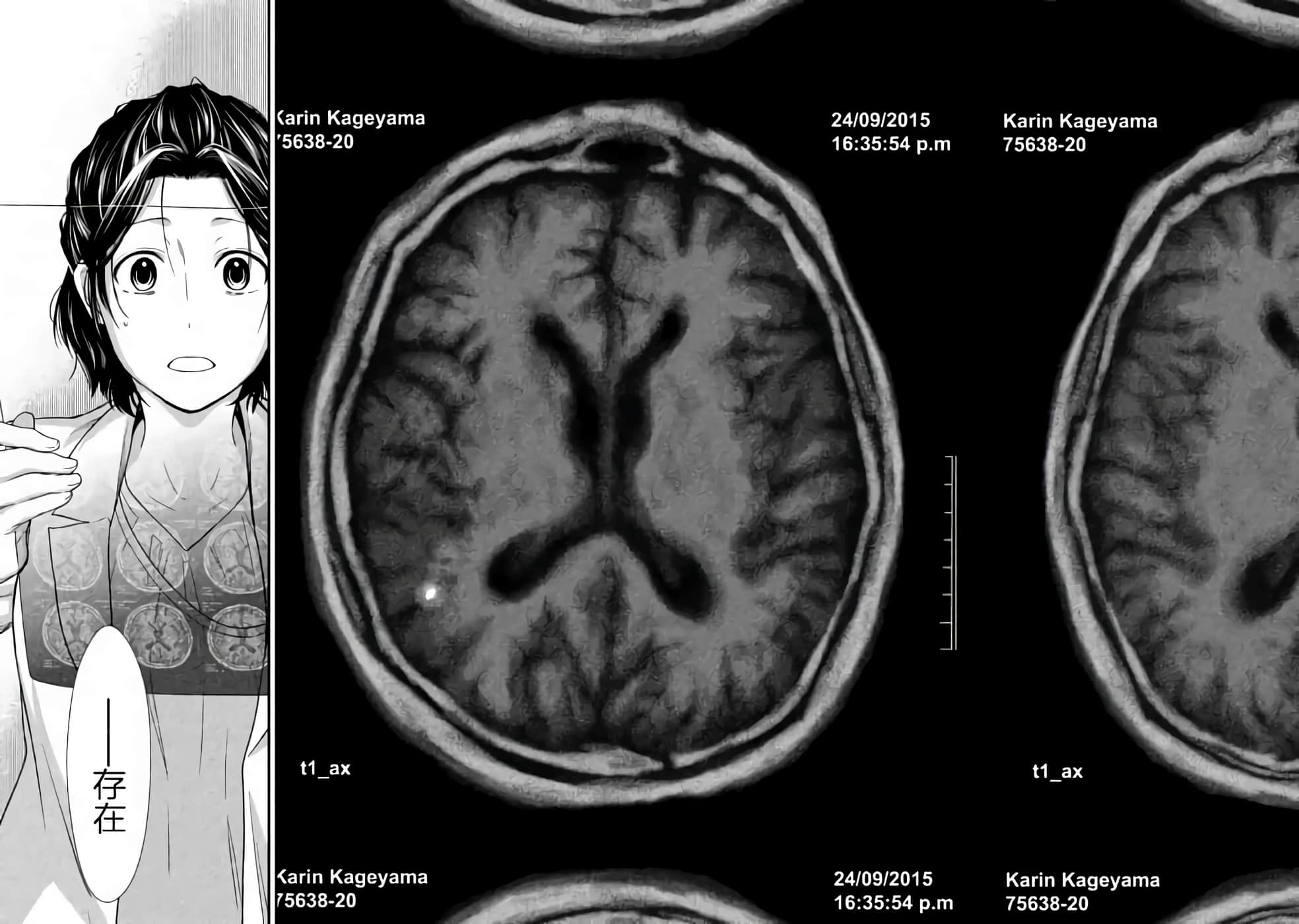 Fragile 病理医生岸京一郎之所见【1-126话 9-126是生肉】【フラジャイル 病理医岸京一郎の所見】-1